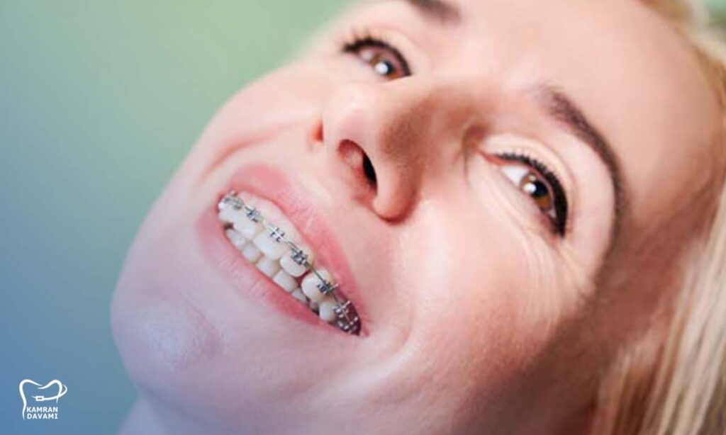 ارتودنسی در سن 40 سالگی قابل انجامه یا دیره؟