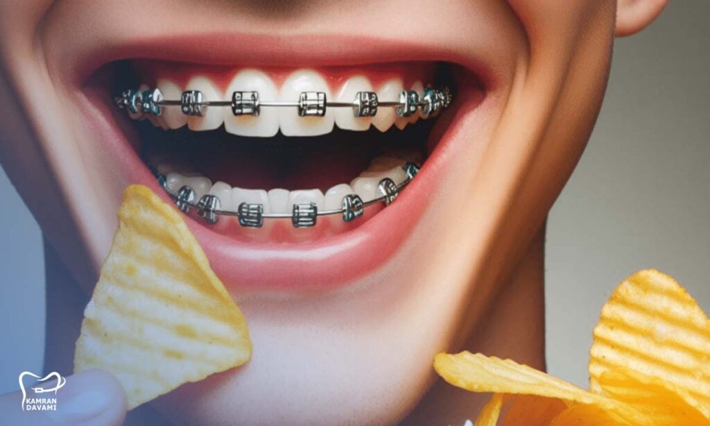 بعد از ارتودنسی چه بخوریم؟ چه نخوریم؟
