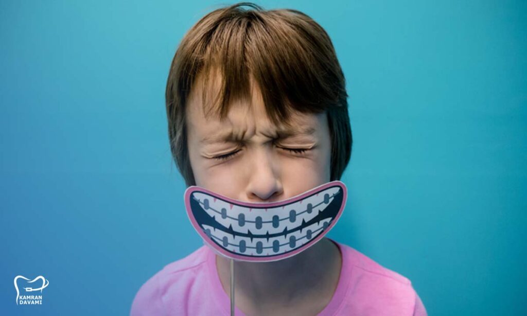 علت التهاب لثه در ارتودنسی چیست؟