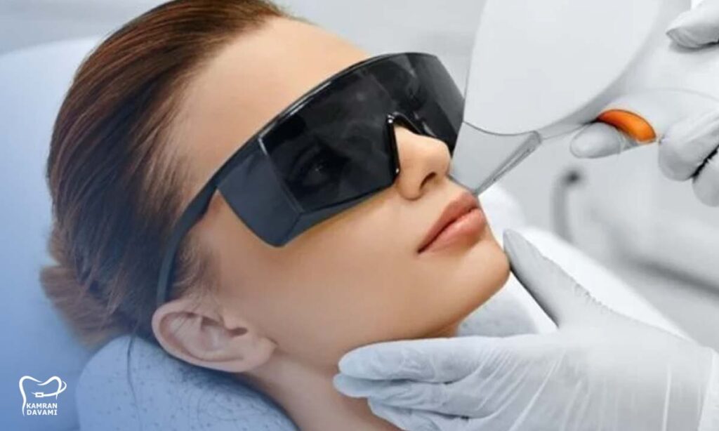 ارتودنسی و لیزر موهای زائد؛ لیزر کنیم یا خطرناکه؟