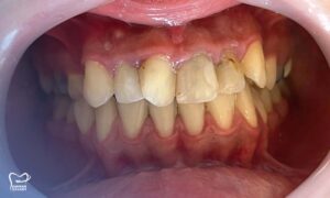 جراحی فک برای ارتودنسی